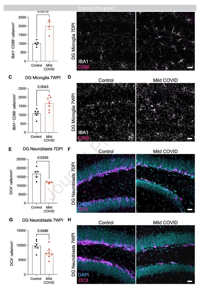 斯坦福、耶鲁研究：新冠感染轻症仍可能导致神经细胞和髓鞘失调