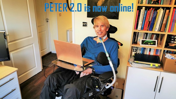 再见，彼得 2.0！世界上第一个真正的赛博格宣告死亡