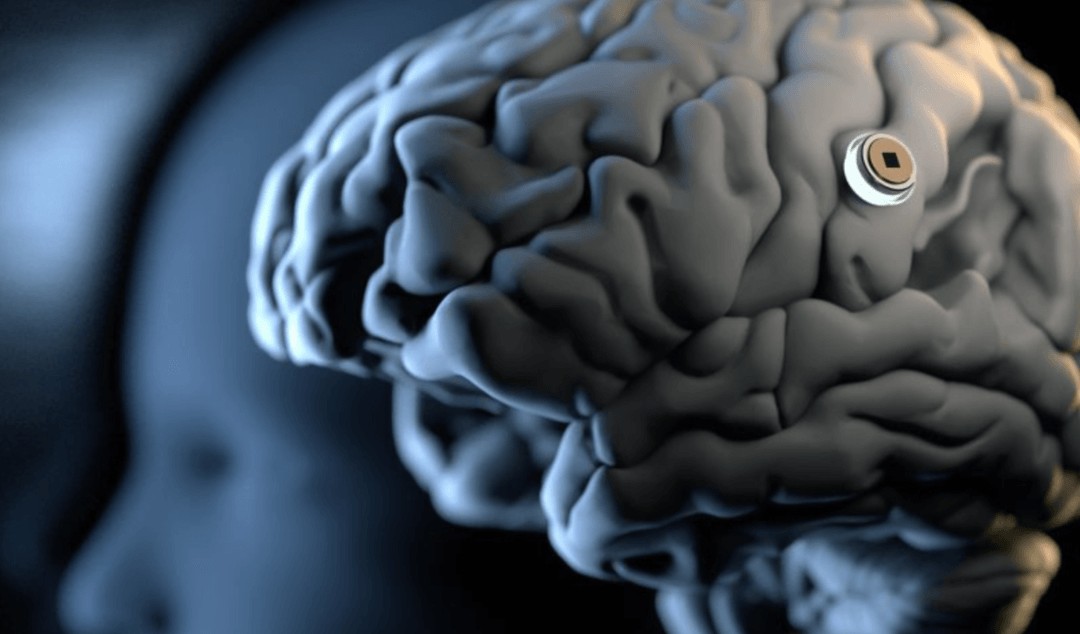 马斯克的脑机接口公司计划“人体试验”，让大脑连接芯片有哪些风险？